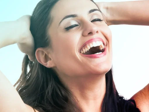 Estética Dental